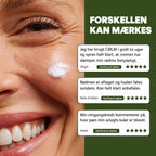 Smilende kvinde med en klat CØLM Redness Relieving Cream på kinden, ved siden af tre kundeanmeldelser med fem stjerner fra verificerede købere.